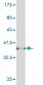 ADCY5 Antibody (monoclonal) (M01)