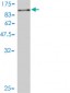 ADD1 Antibody (monoclonal) (M01)