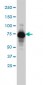 ADD1 Antibody (monoclonal) (M01)