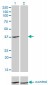 ADH4 Antibody (monoclonal) (M01)