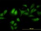 ADRM1 Antibody (monoclonal) (M01)