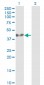 ADRM1 Antibody (monoclonal) (M01)