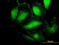 AFP Antibody (monoclonal) (M01)