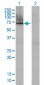 AFP Antibody (monoclonal) (M01)