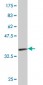 AGT Antibody (monoclonal) (M01)