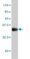 AHCYL1 Antibody (monoclonal) (M05)
