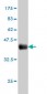 AHCYL1 Antibody (monoclonal) (M05)