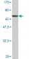 AIPL1 Antibody (monoclonal) (M04)