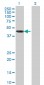 AIPL1 Antibody (monoclonal) (M04)