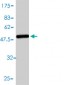 AK1 Antibody (monoclonal) (M01)