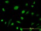 AK1 Antibody (monoclonal) (M06)