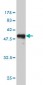 AK1 Antibody (monoclonal) (M06)