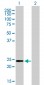 AK1 Antibody (monoclonal) (M06)