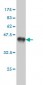 AK1 Antibody (monoclonal) (M08)