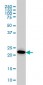 AK1 Antibody (monoclonal) (M08)