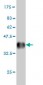 AKAP10 Antibody (monoclonal) (M04)
