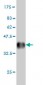 AKAP10 Antibody (monoclonal) (M04)