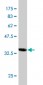 AKAP4 Antibody (monoclonal) (M10)