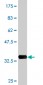 AKR1B10 Antibody (monoclonal) (M01)