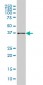 AKR1B10 Antibody (monoclonal) (M01)