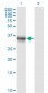 AKR1B10 Antibody (monoclonal) (M01)