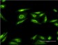 AKR1B10 Antibody (monoclonal) (M03)