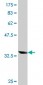 AKR1B10 Antibody (monoclonal) (M03)