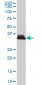 AKR1B10 Antibody (monoclonal) (M03)