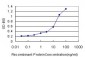 AKR1C2 Antibody (monoclonal) (M03)