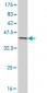 AKR1C2 Antibody (monoclonal) (M03)