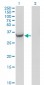 AKR1C2 Antibody (monoclonal) (M03)