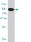 AKR1C4 Antibody (monoclonal) (M01)