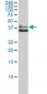 AKR1C4 Antibody (monoclonal) (M01)