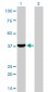 AKR1C4 Antibody (monoclonal) (M01)