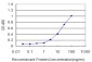 AKR1D1 Antibody (monoclonal) (M03)