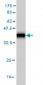 AKR1D1 Antibody (monoclonal) (M03)