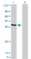 AKR1D1 Antibody (monoclonal) (M03)