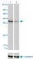 AKR1D1 Antibody (monoclonal) (M03)