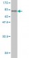 AKT1 Antibody (monoclonal) (M03)