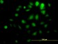 AKT1 Antibody (monoclonal) (M08)