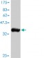 AKT2 Antibody (monoclonal) (M01)