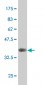 AKT2 Antibody (monoclonal) (M03)