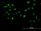 AKT2 Antibody (monoclonal) (M03)