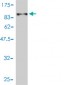 ALB Antibody (monoclonal) (M01)