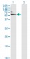 ALB Antibody (monoclonal) (M01)