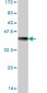 ALDH18A1 Antibody (monoclonal) (M01)
