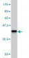 ALDH1L1 Antibody (monoclonal) (M01)