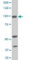 ALDH1L1 Antibody (monoclonal) (M01)