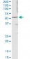 ALDH3A1 Antibody (monoclonal) (M08)