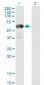 ALDH4A1 Antibody (monoclonal) (M01)